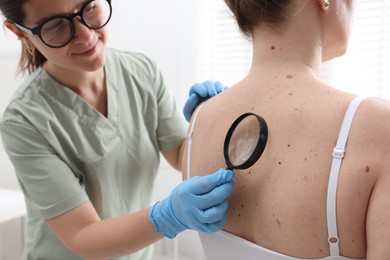Photo of Doctor examining woman's moles in hospital, closeup