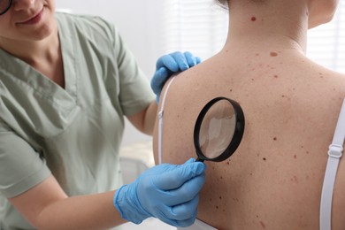 Photo of Doctor examining woman's moles in hospital, closeup