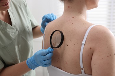 Photo of Doctor examining woman's moles in hospital, closeup