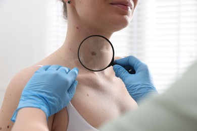 Photo of Doctor examining woman's moles in hospital, closeup