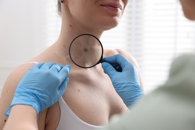 Photo of Doctor examining woman's moles in hospital, closeup
