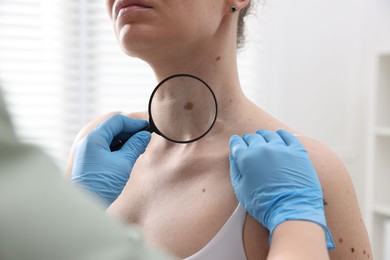 Photo of Doctor examining woman's moles in hospital, closeup