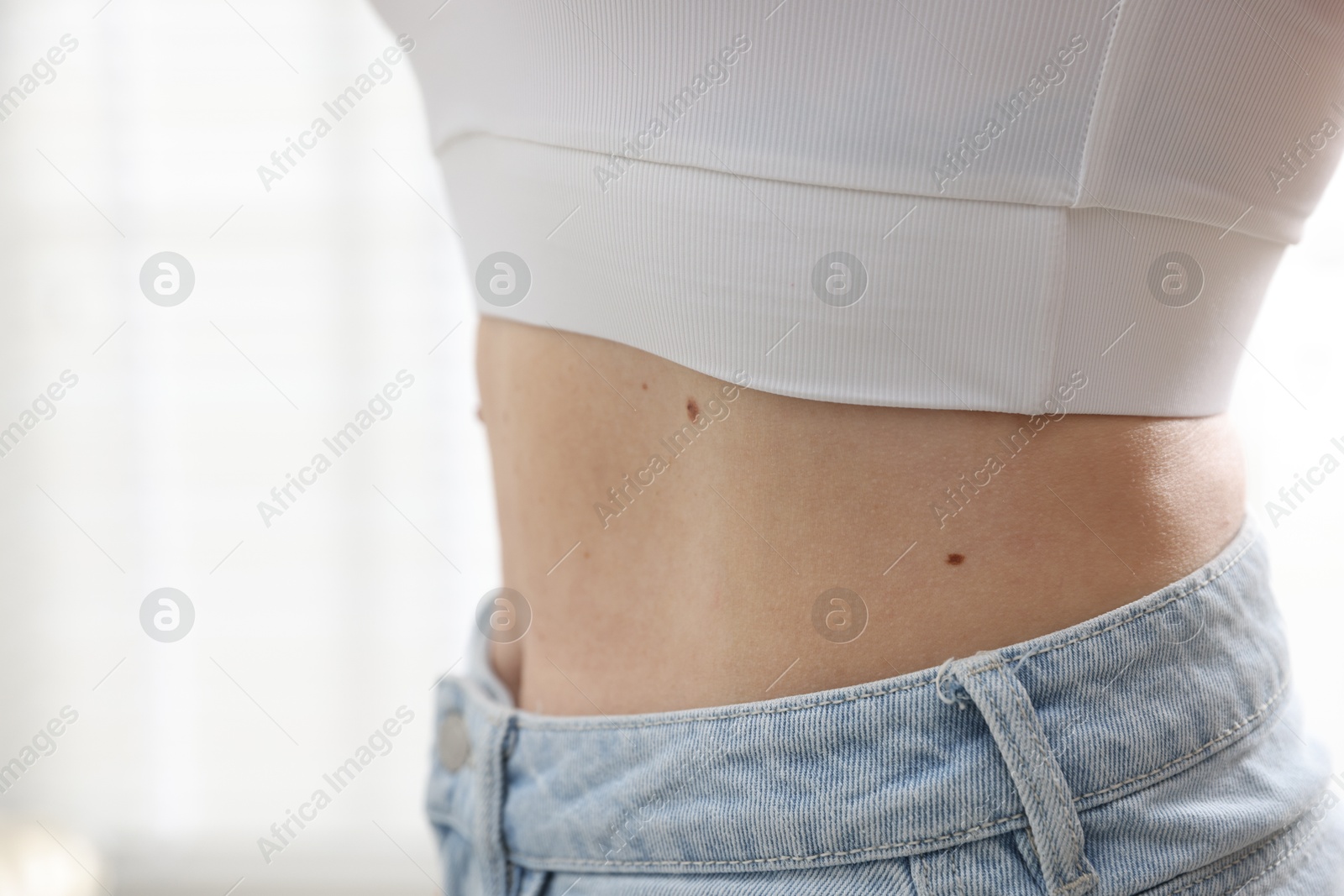 Woman with moles on her body indoors, closeup Photo of Woman with moles on her body indoors, closeup