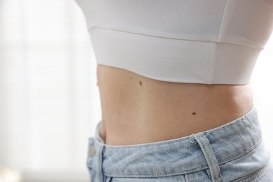 Photo of Woman with moles on her body indoors, closeup