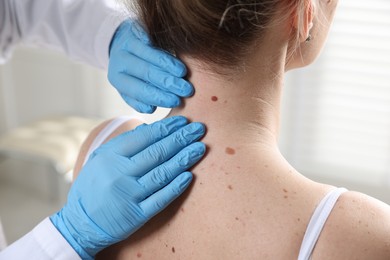 Photo of Doctor examining woman's moles in hospital, closeup