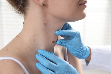 Photo of Doctor examining woman's moles in hospital, closeup