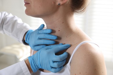 Photo of Doctor examining woman's moles in hospital, closeup