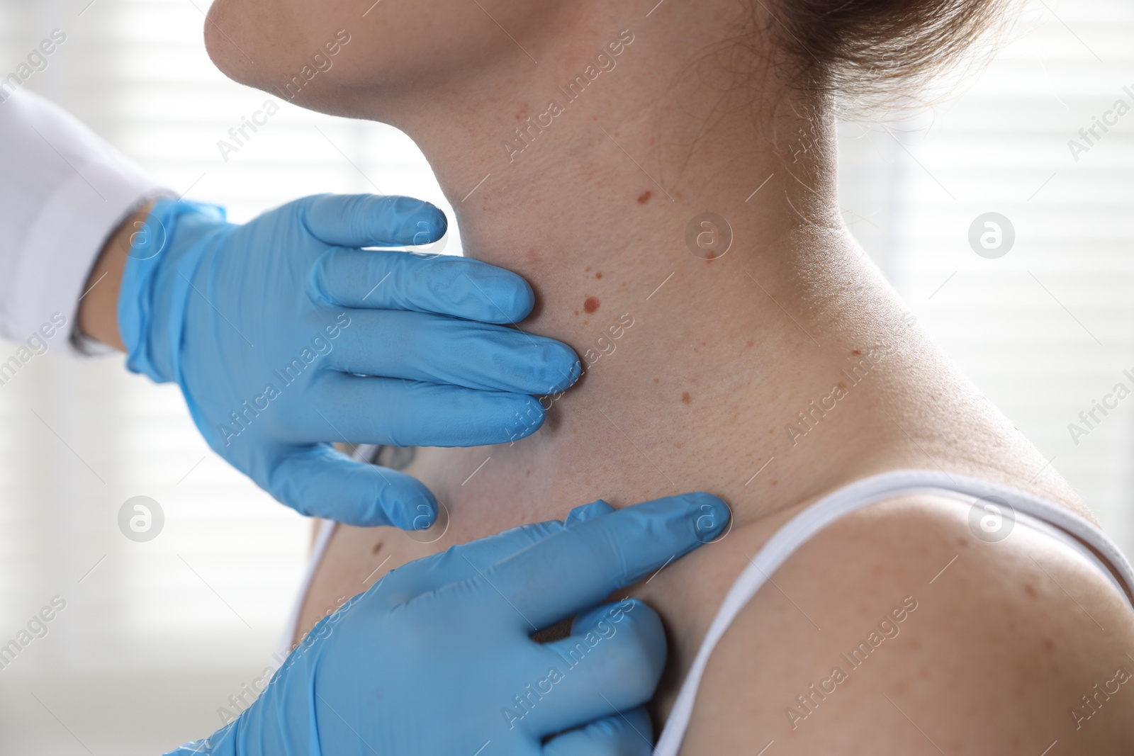 Doctor examining woman's moles in hospital, closeup Photo of Doctor examining woman's moles in hospital, closeup