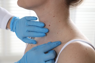 Photo of Doctor examining woman's moles in hospital, closeup