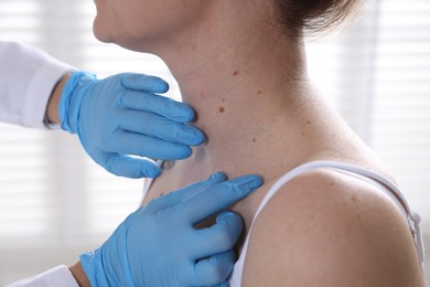 Photo of Doctor examining woman's moles in hospital, closeup