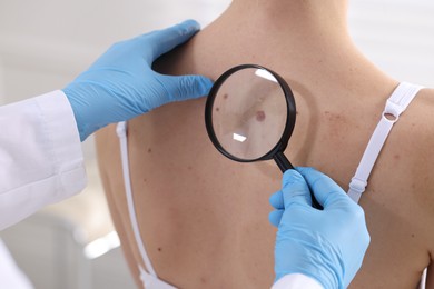 Photo of Doctor examining woman's moles in hospital, closeup