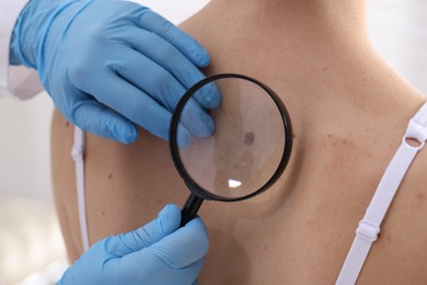 Photo of Doctor examining woman's moles in hospital, closeup