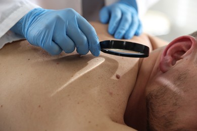 Photo of Doctor examining man's moles in hospital, closeup