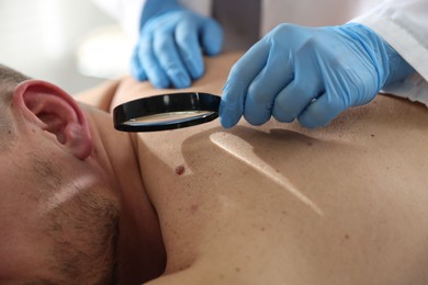 Photo of Doctor examining man's moles in hospital, closeup