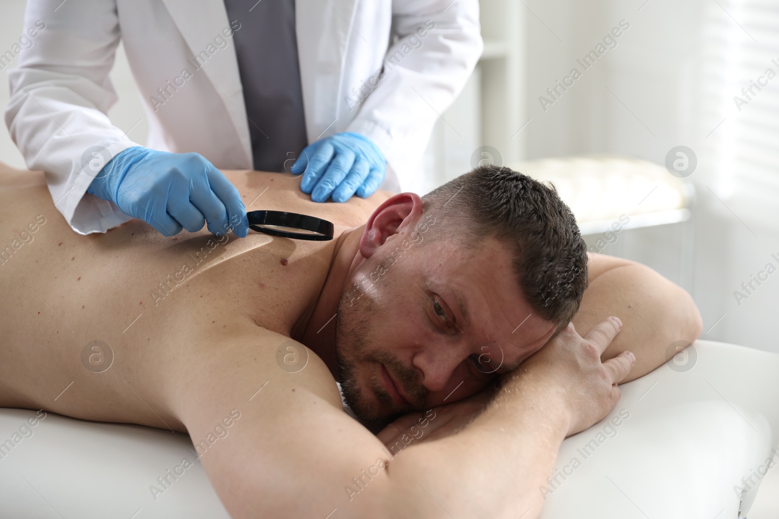Photo of Doctor examining man's moles in hospital, closeup