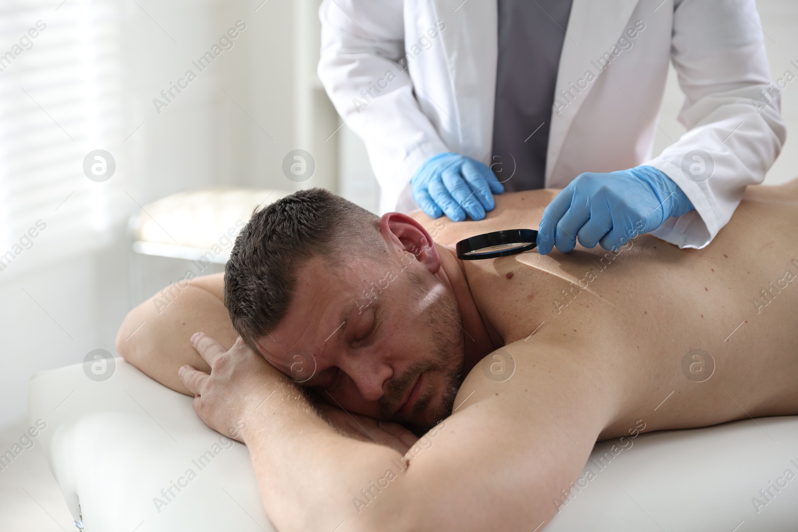 Photo of Doctor examining man's moles in hospital, closeup