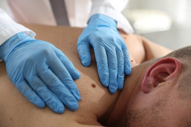 Photo of Doctor examining man's moles in hospital, closeup