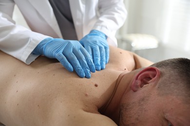 Photo of Doctor examining man's moles in hospital, closeup