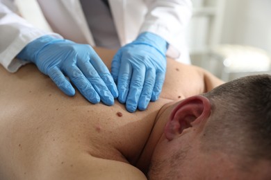 Photo of Doctor examining man's moles in hospital, closeup