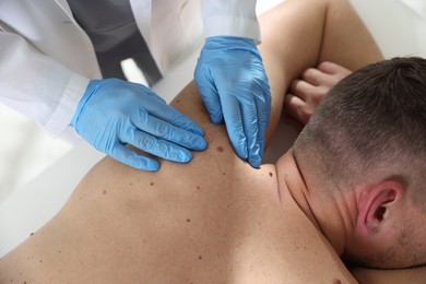Photo of Doctor examining man's moles in hospital, closeup