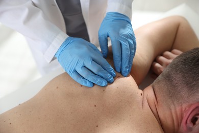Photo of Doctor examining man's moles in hospital, closeup