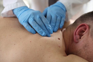 Photo of Doctor examining man's moles in hospital, closeup