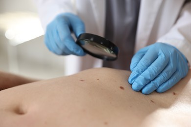 Photo of Doctor examining man's moles in hospital, closeup