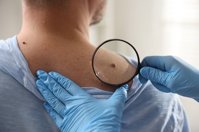 Photo of Doctor examining man's moles in hospital, closeup