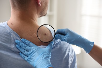 Photo of Doctor examining man's moles in hospital, closeup