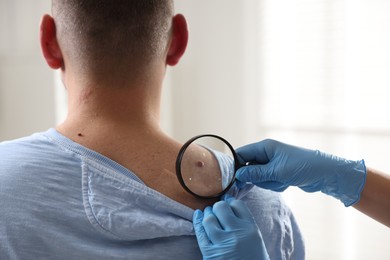 Photo of Doctor examining man's moles in hospital, closeup