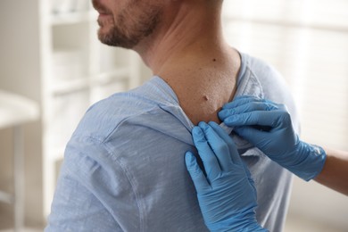 Photo of Doctor examining man's moles in hospital, closeup