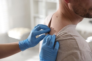 Photo of Doctor examining man's moles in hospital, closeup