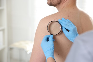 Photo of Doctor examining man's moles in hospital, closeup