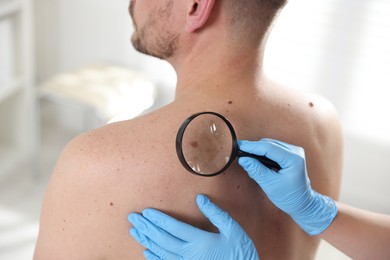 Photo of Doctor examining man's moles in hospital, closeup
