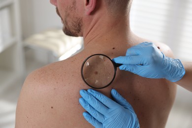 Photo of Doctor examining man's moles in hospital, closeup
