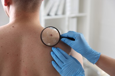Photo of Doctor examining man's moles in hospital, closeup. Space for text