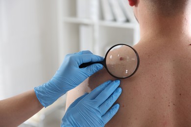 Photo of Doctor examining man's moles in hospital, closeup. Space for text
