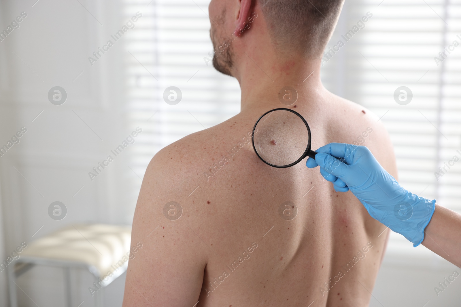 Photo of Doctor examining man's moles in hospital, closeup. Space for text