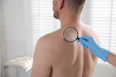Photo of Doctor examining man's moles in hospital, closeup. Space for text