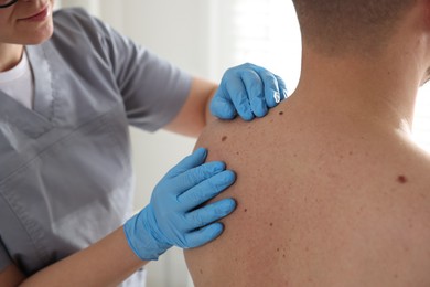 Photo of Doctor examining man's moles in hospital, closeup