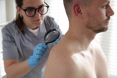 Photo of Doctor examining man's moles in hospital, closeup