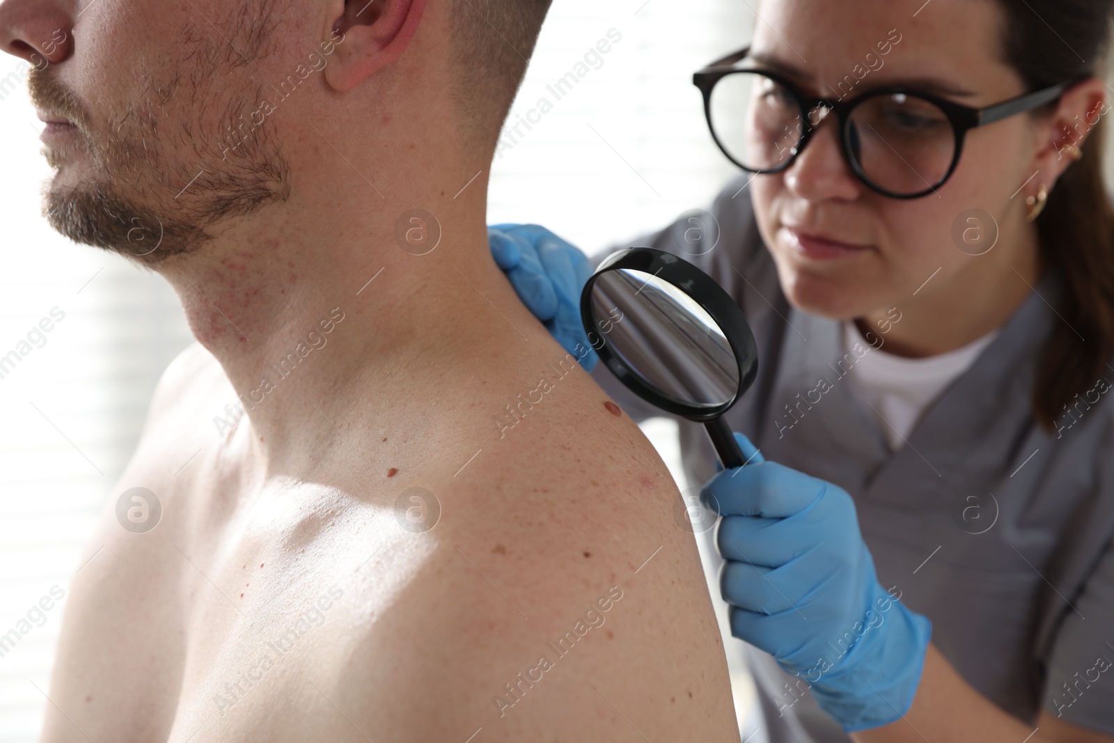 Photo of Doctor examining man's moles in hospital, closeup