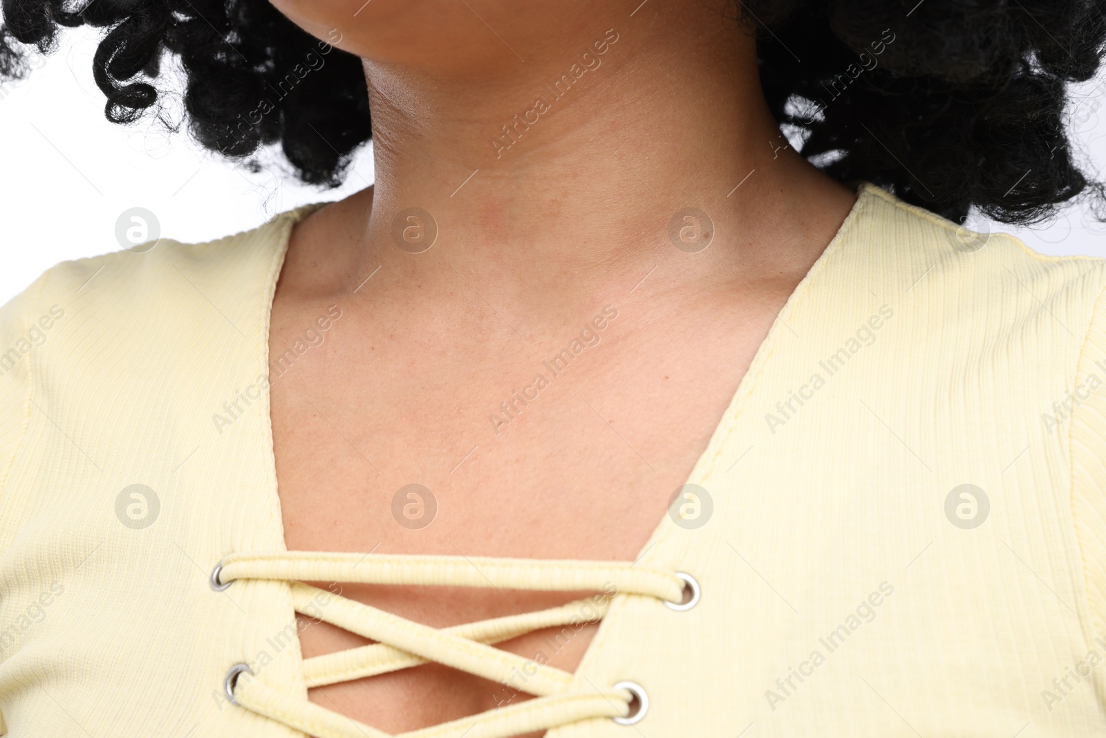 Photo of Young woman with healthy skin on white background, closeup