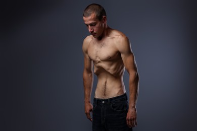 Photo of Man suffering from anorexia on grey background