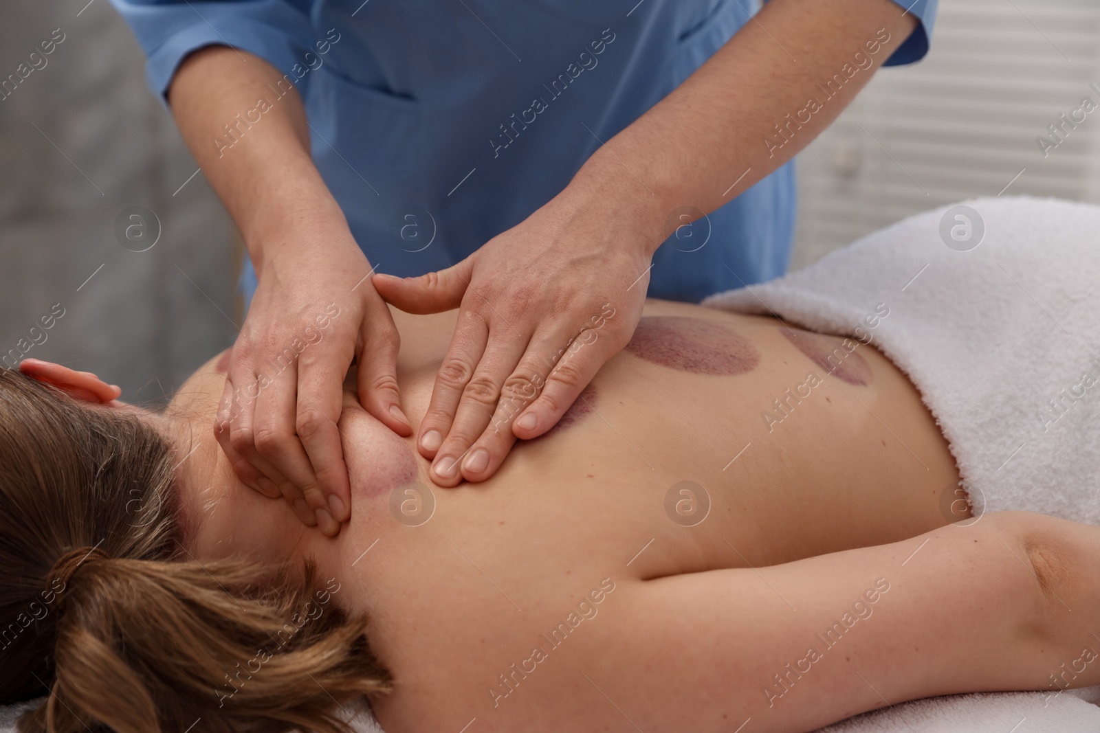Cupping therapy. Woman receiving professional massage in spa salon, closeup Photo of Cupping therapy. Woman receiving professional massage in spa salon, closeup