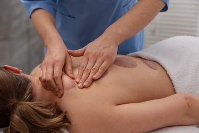 Photo of Cupping therapy. Woman receiving professional massage in spa salon, closeup