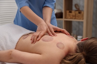 Photo of Cupping therapy. Woman receiving professional massage in spa salon, closeup
