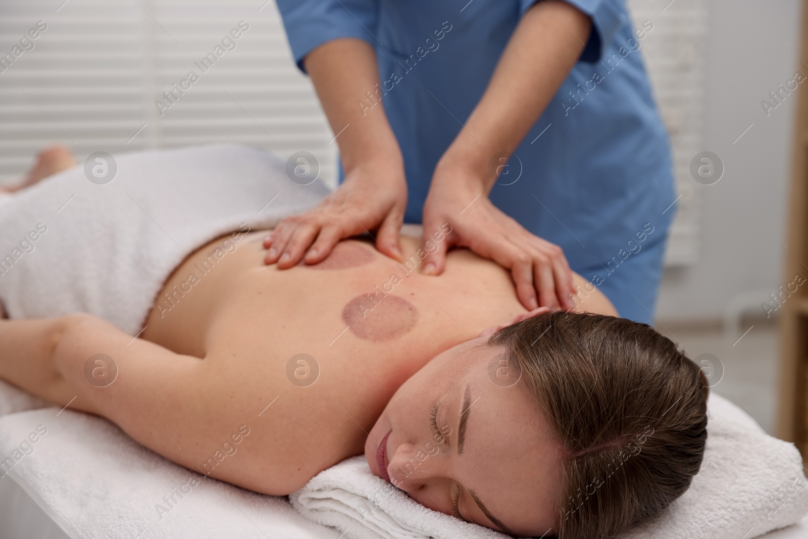 Cupping therapy. Woman receiving professional massage in spa salon Photo of Cupping therapy. Woman receiving professional massage in spa salon