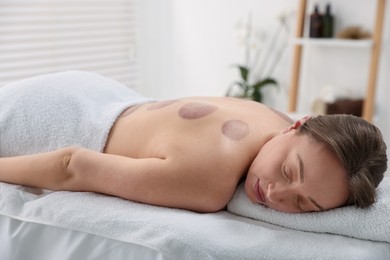 Photo of Woman after cupping therapy in spa salon