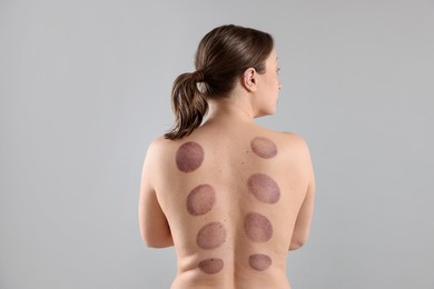Photo of Woman after cupping therapy on gray background, back view